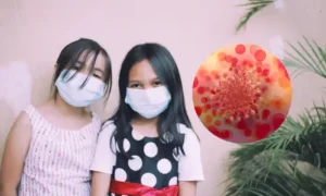 Measles: Causes, Risks, and Prevention