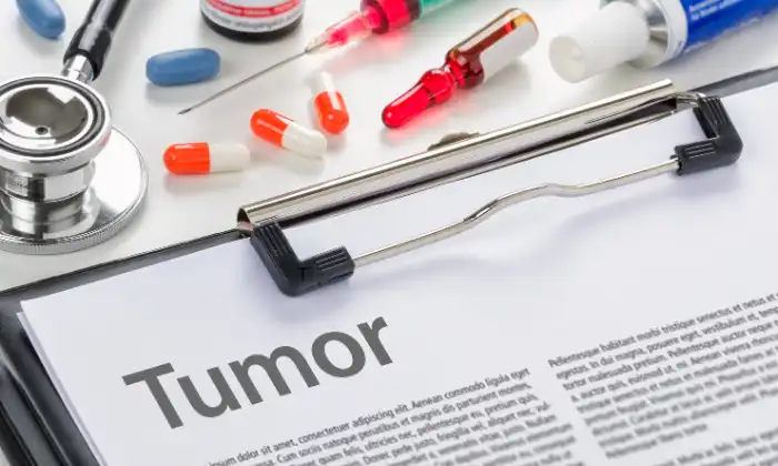Tumor and treatments